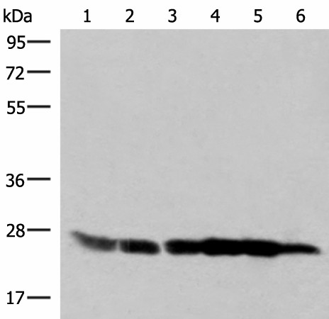 GSTK1 Polyclonal Antibody (E-AB-52860)