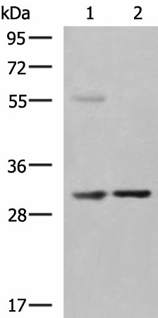 KHK Polyclonal Antibody (E-AB-18181)