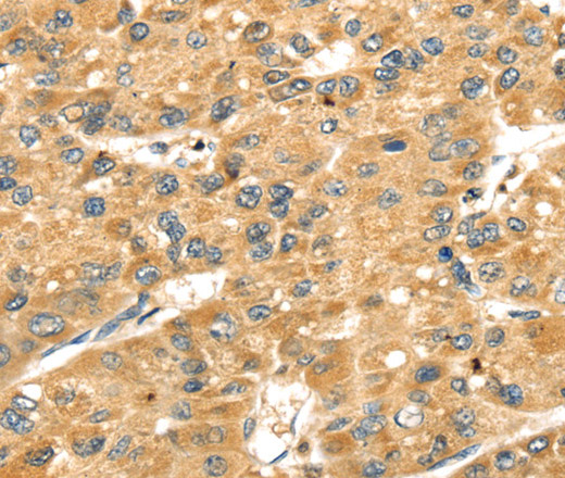 SH3KBP1 Polyclonal Antibody (E-AB-15387)