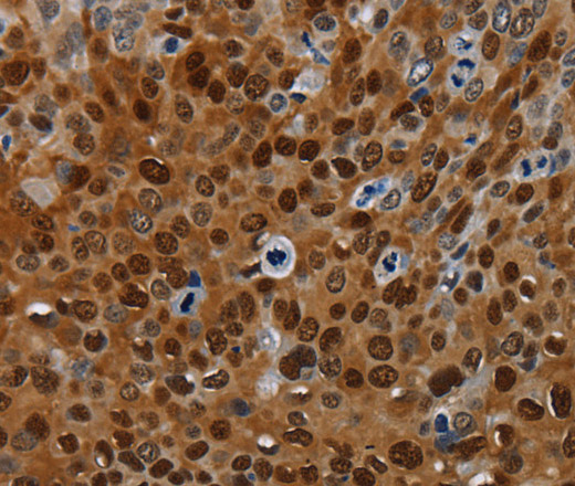 NRP2 Polyclonal Antibody (E-AB-16638)