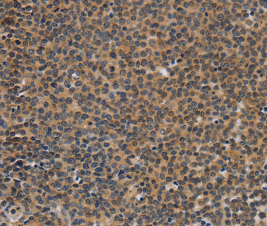 TNFRSF8 Polyclonal Antibody (E-AB-16310)