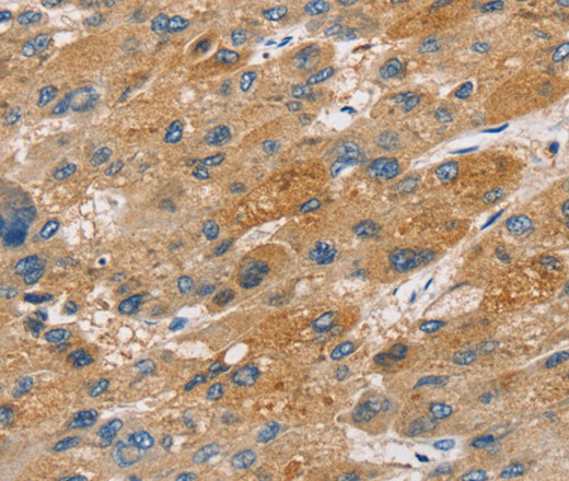 ST18 Polyclonal Antibody (E-AB-11607)