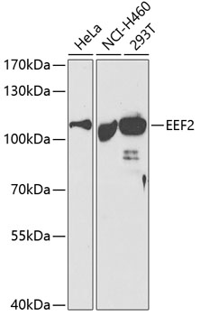 EEF2 Polyclonal Antibody (E-AB-60587)