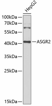 ASGR2 Polyclonal Antibody (E-AB-93389)