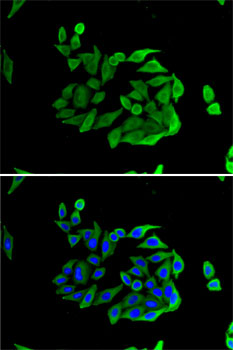 Heparanase 1 Polyclonal Antibody (E-AB-61086)