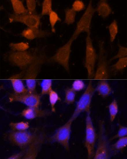 VPS26A Polyclonal Antibody (E-AB-64967)