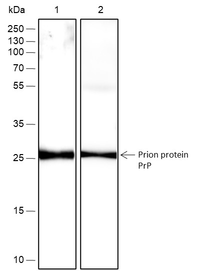 Recombinant Prion protein PrP Monoclonal Antibody (AN301710L)