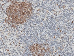 Recombinant CD32b/FCGR2B Monoclonal Antibody (AN300310P)