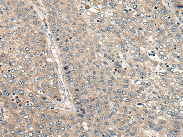 CC2D1A Polyclonal Antibody (E-AB-19669)