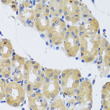 DYNC1I1 Polyclonal Antibody (E-AB-62716)