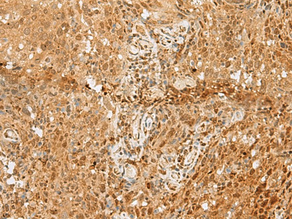 PNRC2 Polyclonal Antibody (E-AB-52809)
