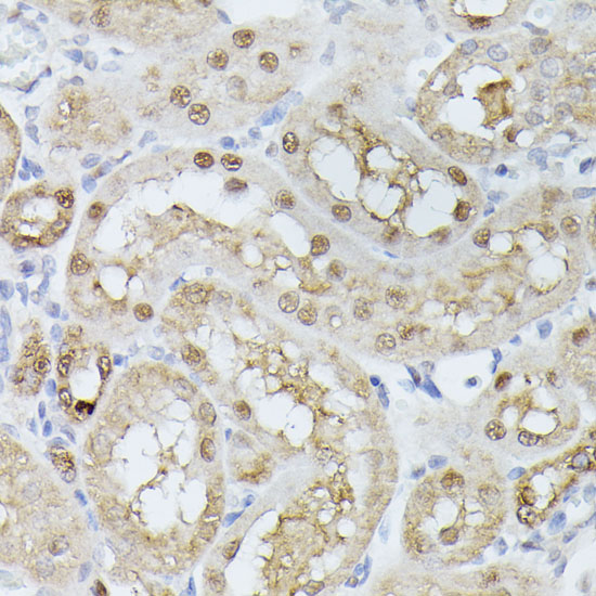 TPI1 Polyclonal Antibody (E-AB-66554)