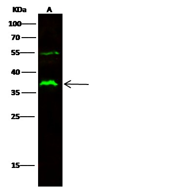 Recombinant CD32a/FCGR2A Monoclonal Antibody (AN300328P)