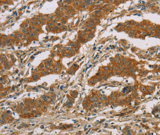 CYP39A1 Polyclonal Antibody (E-AB-11122)