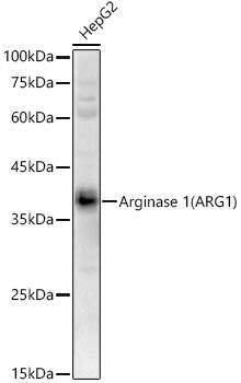 ARG1 / Arginase 1 Polyclonal Antibody (E-AB-68336)