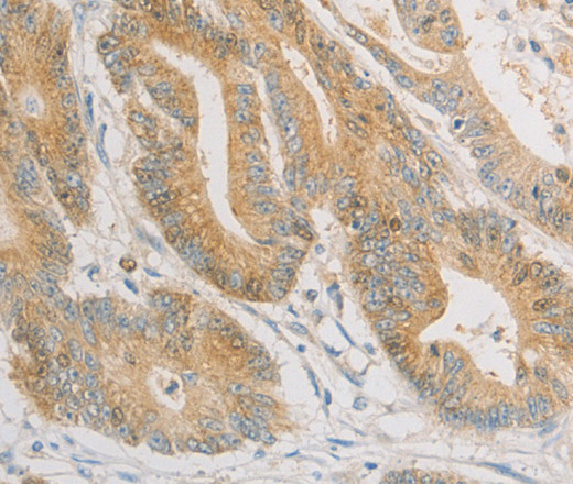 ZWINT Polyclonal Antibody (E-AB-14670)