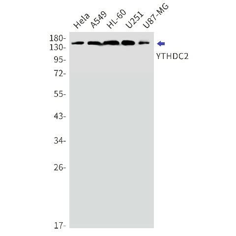 Recombinant YTHDC2 Monoclonal Antibody (E-AB-81516)