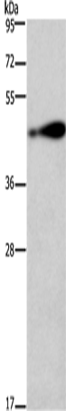 RAGE Polyclonal Antibody (E-AB-13783)