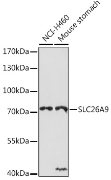 SLC26A9 Polyclonal Antibody (E-AB-92081)