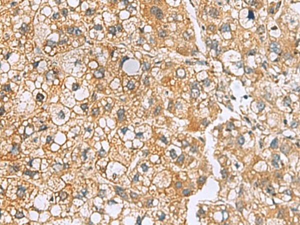 MRPL22 Polyclonal Antibody (E-AB-19168)
