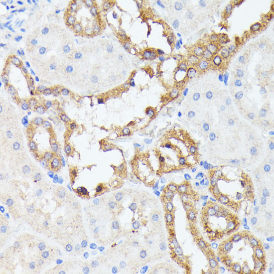 PTP4A2 Polyclonal Antibody (E-AB-65270)