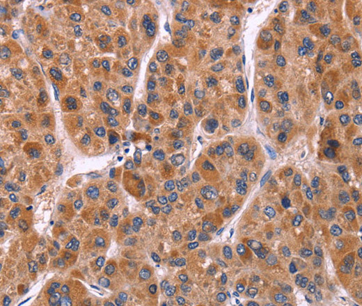 Ephrin A5 Polyclonal Antibody (E-AB-13215)