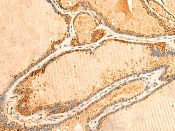 PPM1B Polyclonal Antibody (E-AB-52842)