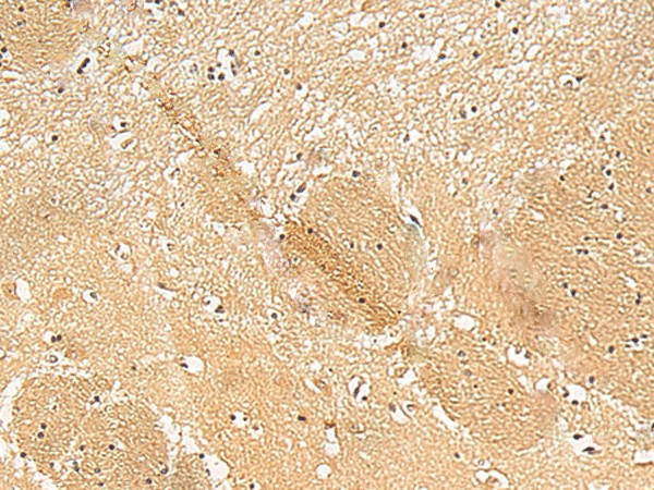 TXNDC12 Polyclonal Antibody (E-AB-18914)