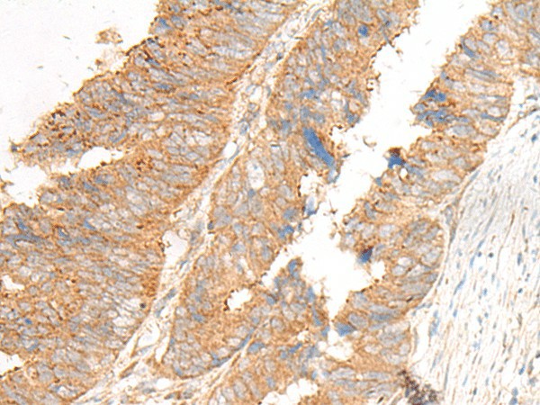GLIS1 Polyclonal Antibody (E-AB-18002)