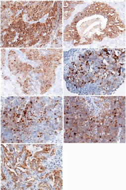 Recombinant WAP5/WFDC2/HE4 Monoclonal Antibody (AN300427P)
