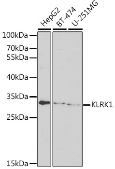 KLRK1 Polyclonal Antibody (E-AB-67726)