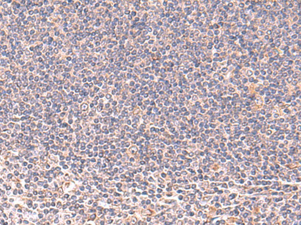 MANSC1 Polyclonal Antibody (E-AB-19036)