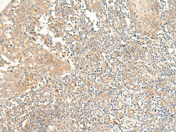 PTGDR2 Polyclonal Antibody (E-AB-18034)