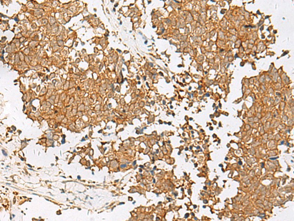 GSTM2 Polyclonal Antibody (E-AB-18062)