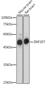 ZNF207 Polyclonal Antibody (E-AB-92189)