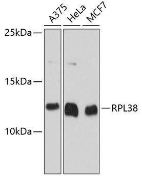 RPL38 Polyclonal Antibody (E-AB-63614)