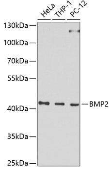 BMP2 Polyclonal Antibody (E-AB-60027)