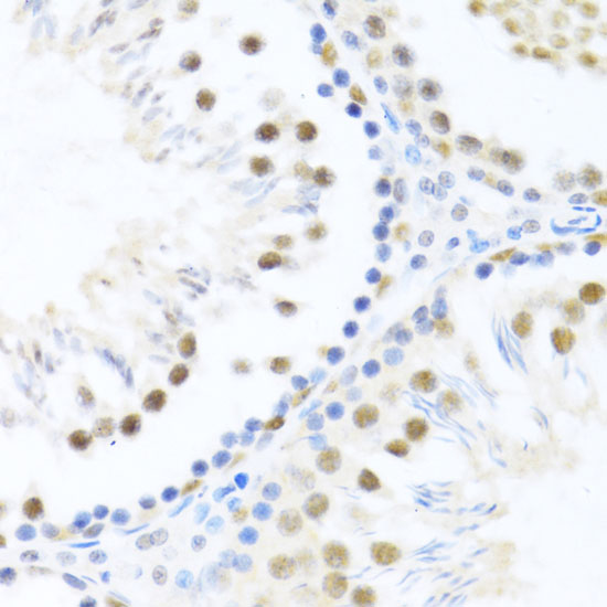 DDX46 Polyclonal Antibody (E-AB-65476)