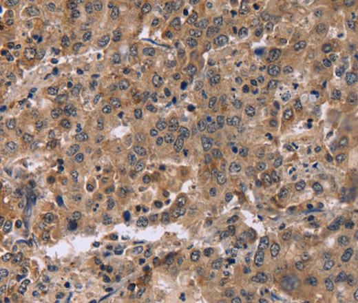 FAM107A Polyclonal Antibody (E-AB-11213)
