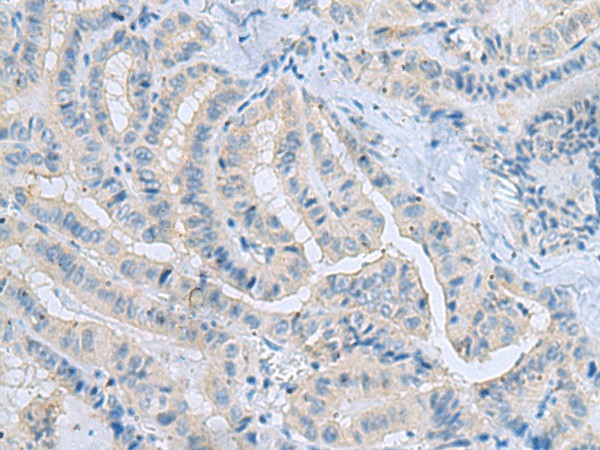 MSI2 Polyclonal Antibody (E-AB-53150)