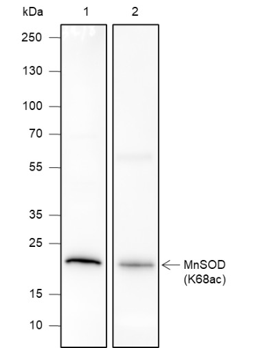 Recombinant SOD2 (Acetyl Lys68) Monoclonal Antibody (AN301412L)