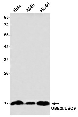 Recombinant SUMO Conjugating Enzyme UBC9 Monoclonal Antibody (E-AB-81514)