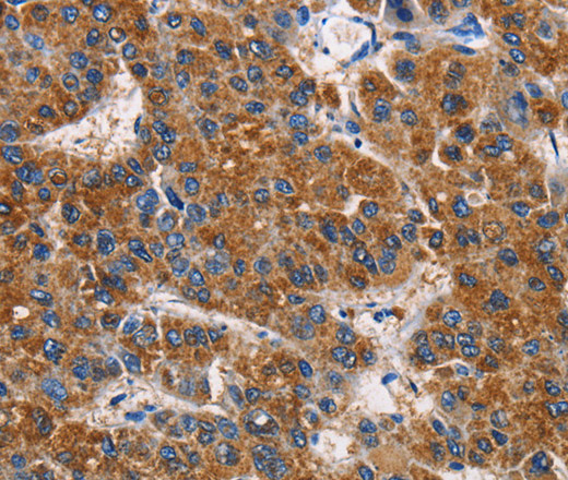 APLNR Polyclonal Antibody (E-AB-10156)