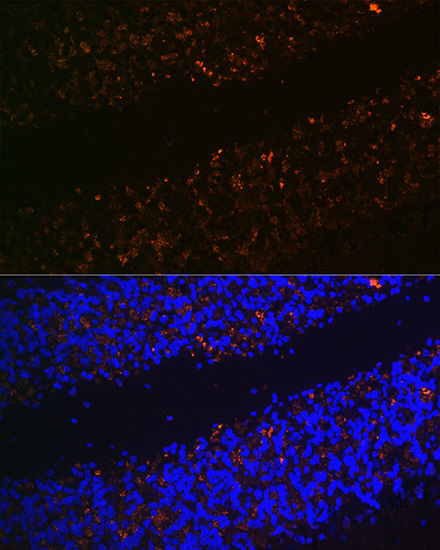 SLC17A6 Polyclonal Antibody (E-AB-66452)