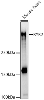 RYR2 Polyclonal Antibody (E-AB-68253)