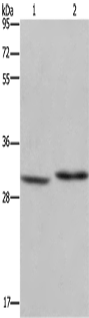 DHRS3 Polyclonal Antibody (E-AB-11158)