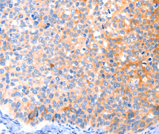 CCDC88A Polyclonal Antibody (E-AB-13059)