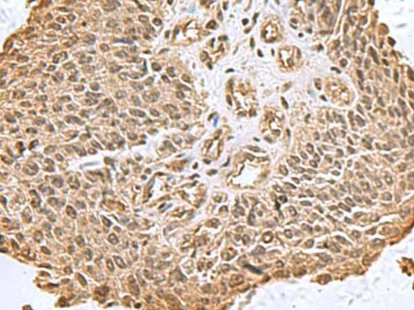 DCTPP1 Polyclonal Antibody (E-AB-53056)