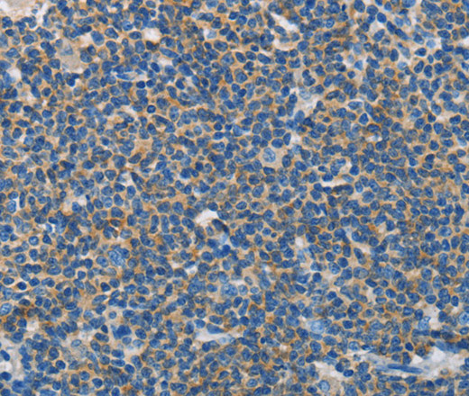 NEK5 Polyclonal Antibody (E-AB-13022)