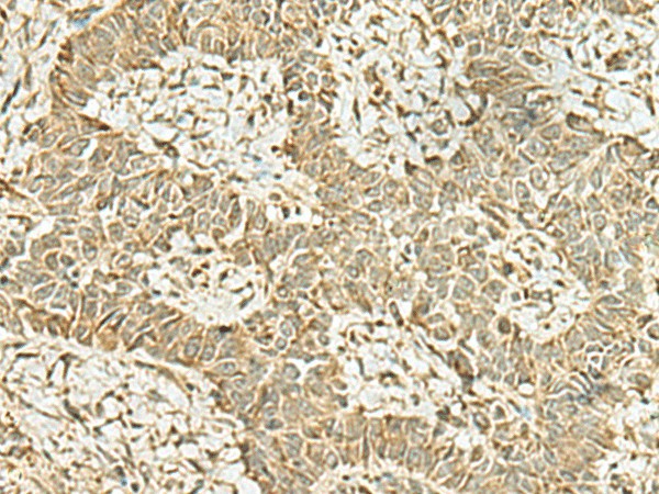 KAT7 Polyclonal Antibody (E-AB-52072)